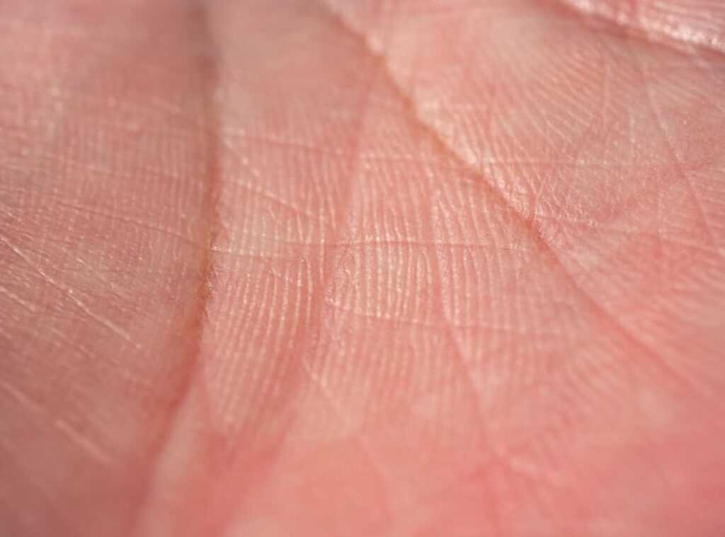 identify skin type